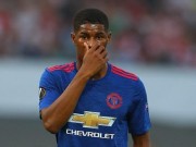 Bóng đá - MU: SAO trẻ Rashford, &quot;phụ kêu chính xịt&quot;