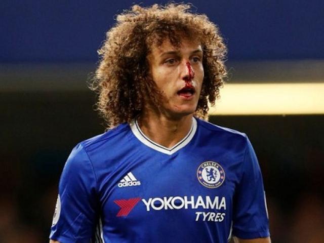 Bóng đá - David Luiz vỡ mũi, "bẽ mặt" ngày ra mắt Chelsea