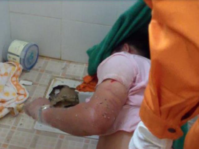 Phi thường - kỳ quặc - Chàng trai bị kẹt tay trong bồn cầu suốt đêm vì điện thoại rơi