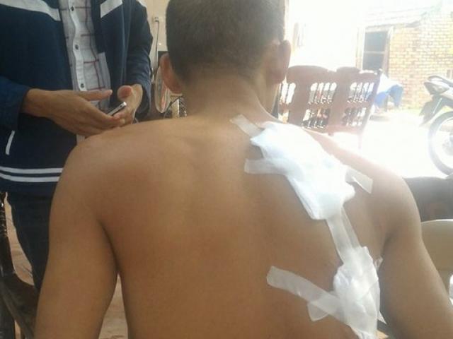 Pháp luật - Mâu thuẫn trong đám cưới, vác dao chém 3 người