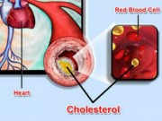 Sức khỏe đời sống - Kẻ thù âm thầm đang giết chết nhiều người trẻ tuổi