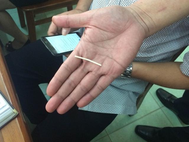 Sức khỏe đời sống - Cấy que tránh thai vẫn có bầu: Trường hợp thất bại hy hữu!