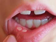 Sức khỏe đời sống - Cha mẹ cần lưu ý điều này sau khi trẻ phải điều trị bằng hóa chất
