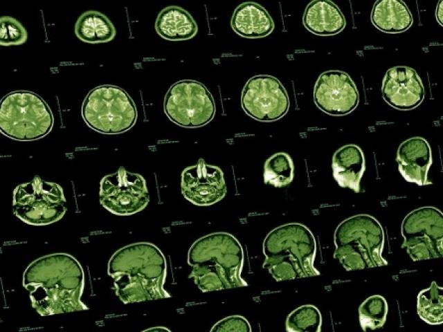 Giáo dục - du học - Phát hiện bí mật động trời về những đặc điểm chung của thiên tài