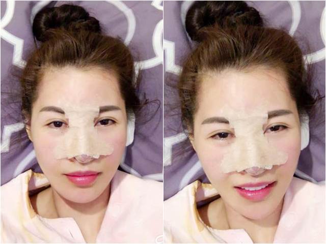 Thẩm mỹ viện - Sốc: Tình cũ Trường Giang tiếp tục "đập mặt" tại Hàn Quốc