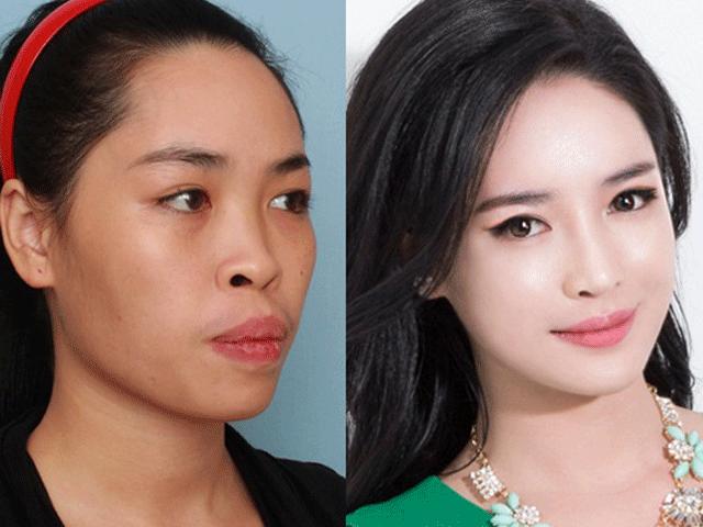 Thẩm mỹ viện - Hot girl Nam Định ước tính "đập toàn mặt" tốn 1,5 tỷ đồng