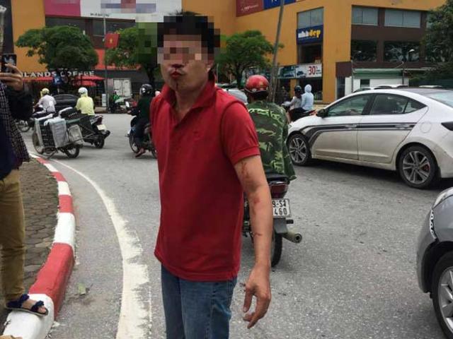 Pháp luật - Tài xế ôtô bị đấm chảy máu mặt sau va chạm với xe máy
