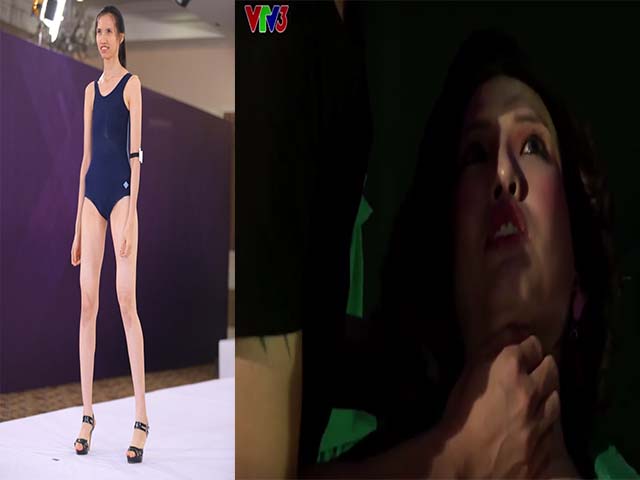 Người mẫu - Hoa hậu - "Thánh xỉu" cao 1m91 gây tranh cãi dữ dội trên truyền hình