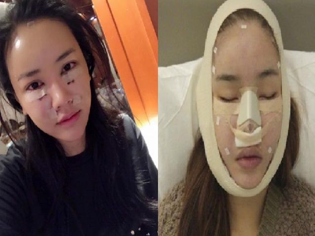 Làm đẹp - Ngất trước những khuôn mặt kỳ dị khi mới "dao kéo" của sao Việt