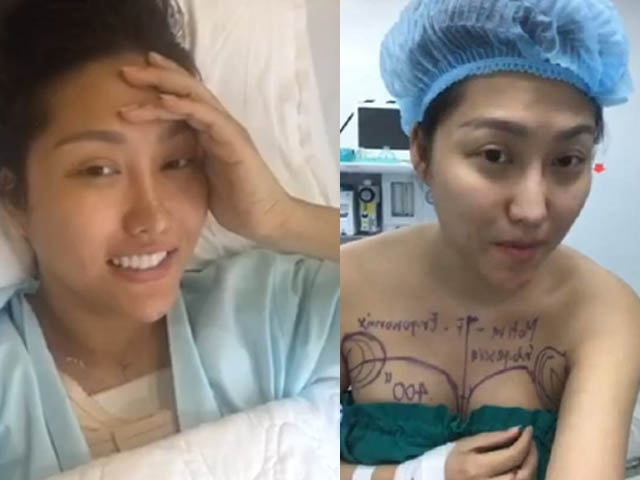 Phim - "Rợn người" trước quá trình đại phẫu 45 tiếng của Phi Thanh Vân