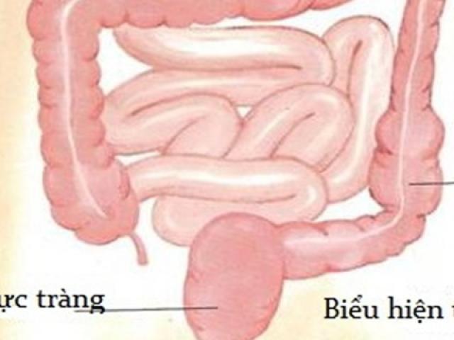 Sức khỏe đời sống - Táo bón tưởng đơn giản nhưng cực kỳ nguy hiểm