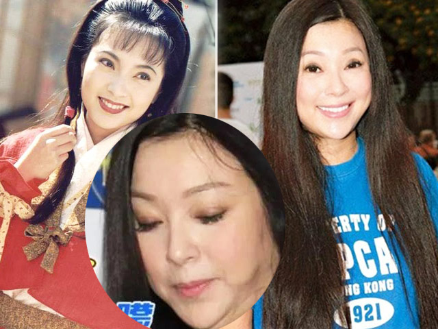 Bí quyết làm đẹp - "Con gái Quách Tĩnh đại hiệp" biến dạng mặt vì ham thẩm mỹ