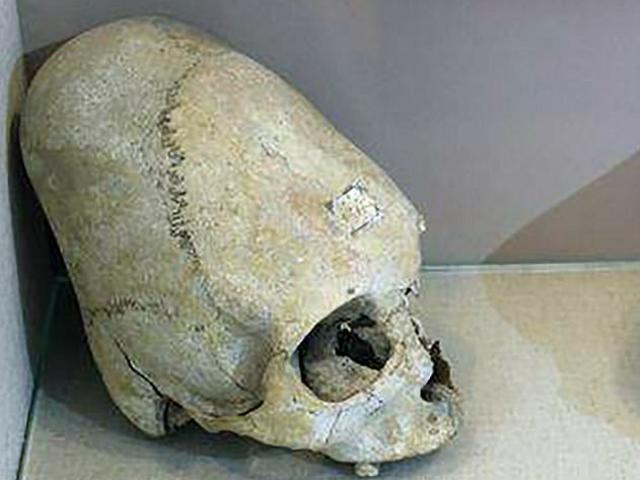 Phi thường - kỳ quặc - Sự thật về hài cốt “người ngoài hành tinh” gây chấn động ở Crimea