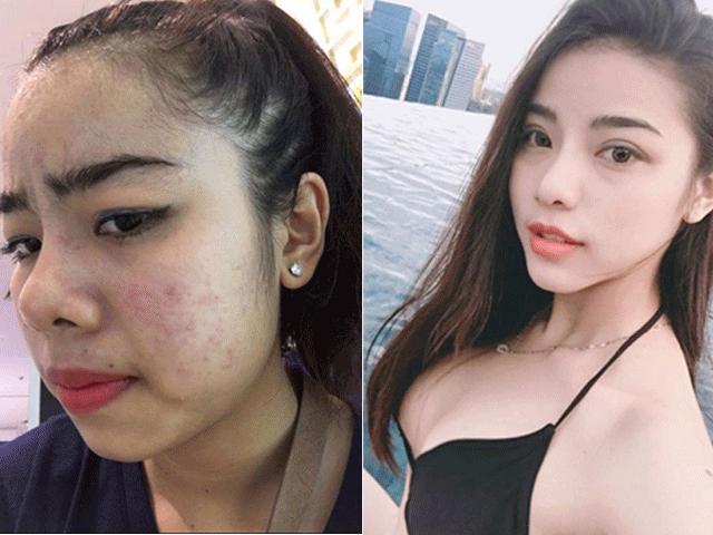 Bạn trẻ - Cuộc sống - Mãn nhãn ngắm 9X Cần Thơ từ "vịt hóa thiên nga" nhờ "dao kéo"