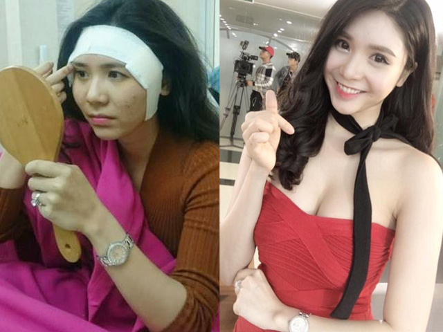 Phim - Thực hư chuyện Thanh Bi "đập đi xây lại" toàn bộ cơ thể gây sốc