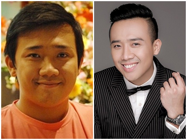 Thẩm mỹ viện - Bất ngờ với "nhan sắc" của Trấn Thành trước khi cưới Hari Won