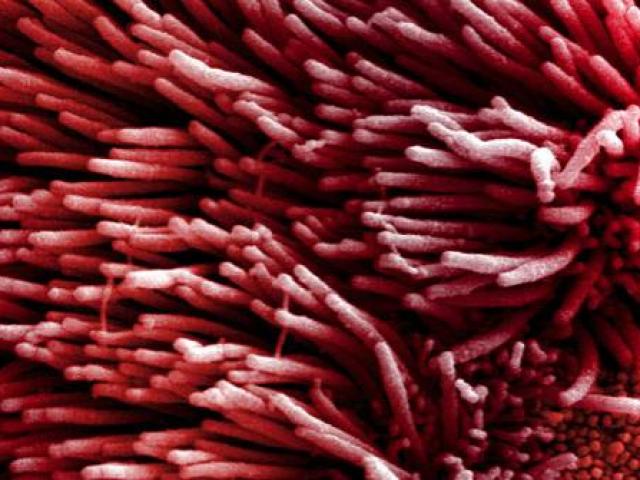 Sức khỏe đời sống - Ngược đời chuyện mỗi người chi 2,7 triệu mỗi năm để "mua" bệnh ung thư