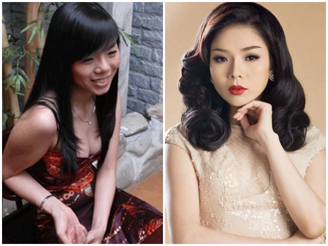 Thẩm mỹ viện - Quyết định "lên đời" nhan sắc đúng đắn nhất của Lệ Quyên