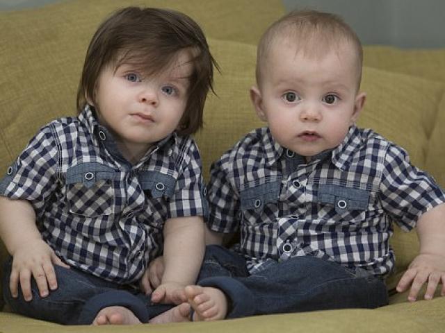 Thế giới - Anh: Cặp sinh đôi giống nhau mọi thứ trừ bộ tóc