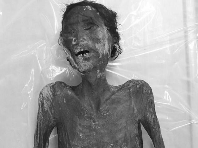 Thế giới - Hàn Quốc: Phát hiện trứng sán trong gan xác ướp 375 tuổi