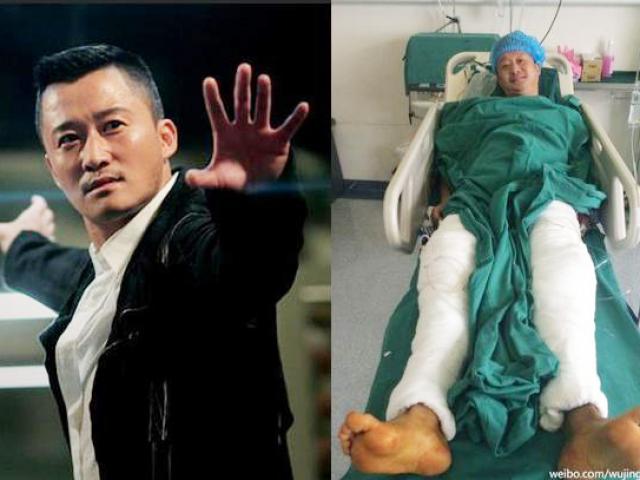 Phim - Ngô Kinh: "Trên người tôi có trên dưới 100 mũi khâu"