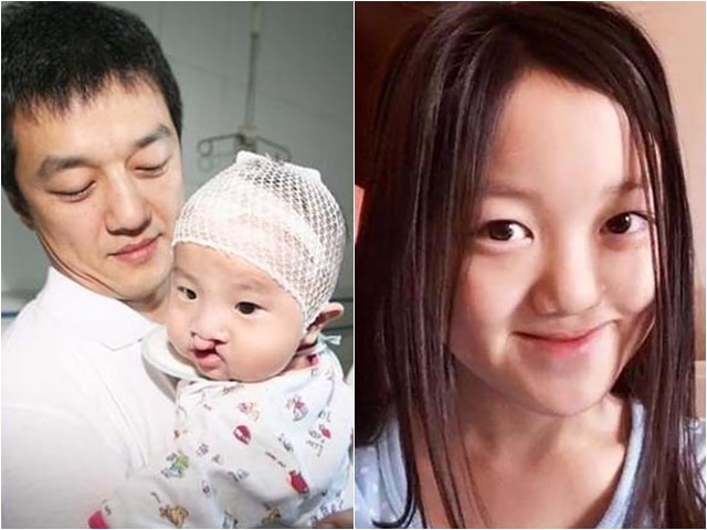 Đời sống Showbiz - Con gái dị tật của sao "Tiếu ngạo giang hồ" giờ đã xinh đẹp giống mẹ