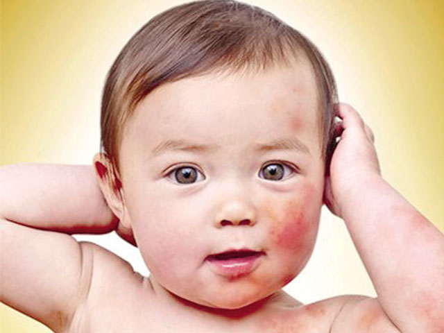 Sức khỏe đời sống - 10 bệnh trẻ hay gặp lúc giao mùa và cách phòng tránh