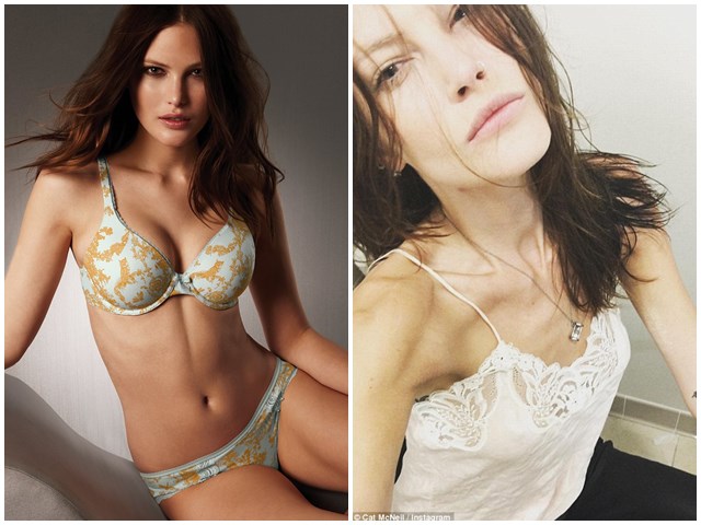 Người mẫu - Hoa hậu - Thân hình "ma đói" gây sốc của mẫu đồng tính đắt giá nhất thế giới