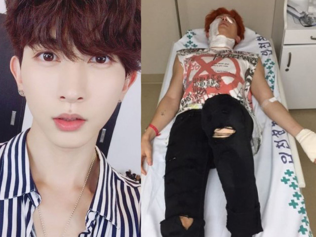 Ca nhạc - MTV - Đang quay MV, nam ca sĩ bị bỏng khắp cơ thể