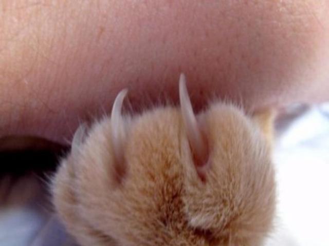 Sức khỏe đời sống - Thanh niên mắc chứng bất lực sau khi bị mèo cào