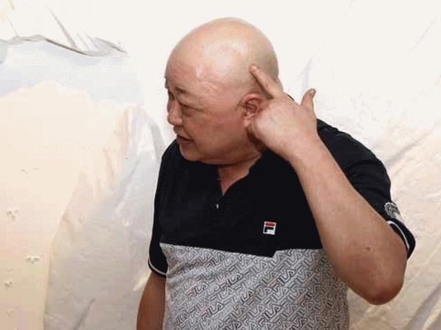 Đời sống Showbiz - "Bao Công" Kim Siêu Quần lần đầu xuất hiện sau đại phẫu u não