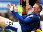 Bóng đá - Everton - Bournemouth: Rooney đổ máu, người hùng dự bị