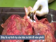 Sức khỏe đời sống - Phổi của bạn trông như thế nào sau khi hút 20 điếu thuốc lá?