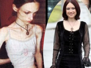 Bí quyết làm đẹp - 8 "bộ xương khô" khỏe, đẹp bất ngờ nhờ tăng cân