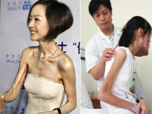 Làm đẹp cùng sao - Hậu họa từ trào lưu "xương khô" ở Trung Quốc