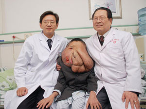 Phi thường - kỳ quặc - Phẫu thuật cho người đàn ông “mặt voi”