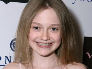 Sức khỏe đời sống - Niềng răng, trẻ 12 tuổi nuốt cả dây kẽm