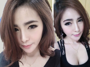 Thẩm mỹ viện - Bàng hoàng với 4 ca chết thảm vì phẫu thuật thẩm mỹ