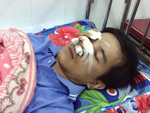 Pháp luật - Nhóm côn đồ truy sát cả gia đình