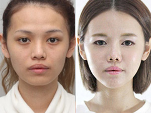 Thẩm mỹ viện - Hot girl Singapore bị "ném đá" vì dao kéo quá nhiều