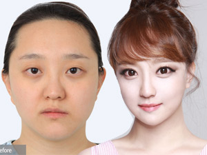 Thẩm mỹ viện - Con không nhận ra vì mẹ trẻ như 18 sau “dao kéo”