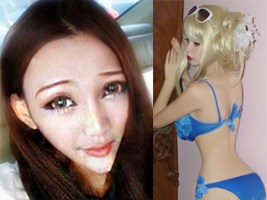 Thẩm mỹ viện - 3 kiểu phẫu thuật thẩm mỹ nguy hiểm nhất