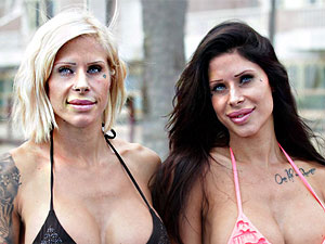 Thẩm mỹ viện - Cặp chị em sinh đôi thành tượng sáp vì nghiện dao kéo