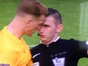 Bóng đá - Húc đầu vào mặt trọng tài, Joe Hart thoát thẻ đỏ