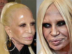 Xu hướng thời trang - Sốc với gương mặt bất thường của "bà trùm" Versace