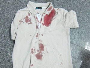 Pháp luật - Hung thủ mặc nguyên chiếc áo dính máu ra đường