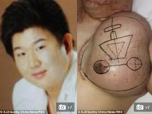 Phi thường - kỳ quặc - Kỳ lạ người đàn ông có "mặt" mọc trên ngực