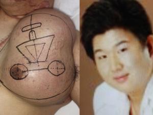 Người đàn ông nuôi mặt bên trong ngực