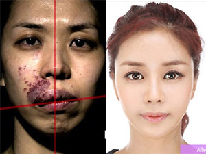 Thẩm mỹ viện - Bất ngờ với 11 "siêu phẩm thẩm mỹ" ở xứ sở kim chi