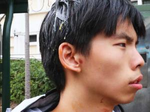 Tin tức trong ngày - Thủ lĩnh biểu tình Hong Kong bị ném trứng thối